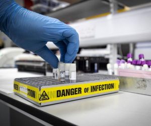 İran’da  corona virüse bağlı  ölü sayısı 5’e yükseldi