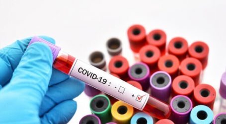 Oxford :Covid-19’a karşı güvenli ve etkili bir aşı bulundu